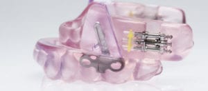 Snarskena snarkskena apotek snarkskena bäst i test