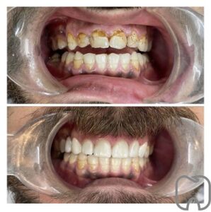 Tandläkare stockholm Tandläkare norsborg