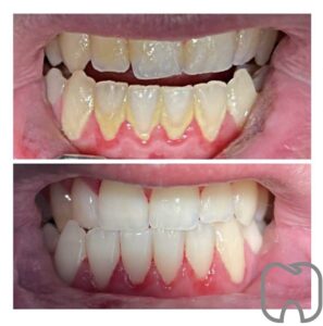 image0 tandhgygienist Stockholm