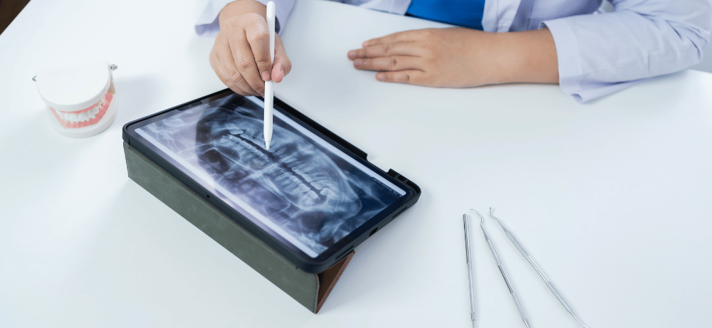 tandläkare går igenom hur tandlossning fungerar på en röntgenbild
