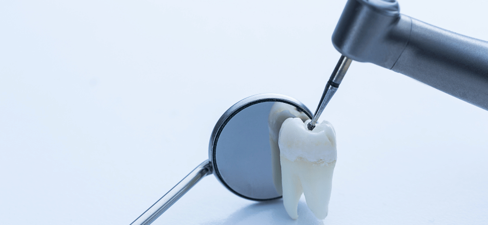 verktyg för tandlagning tandlagning