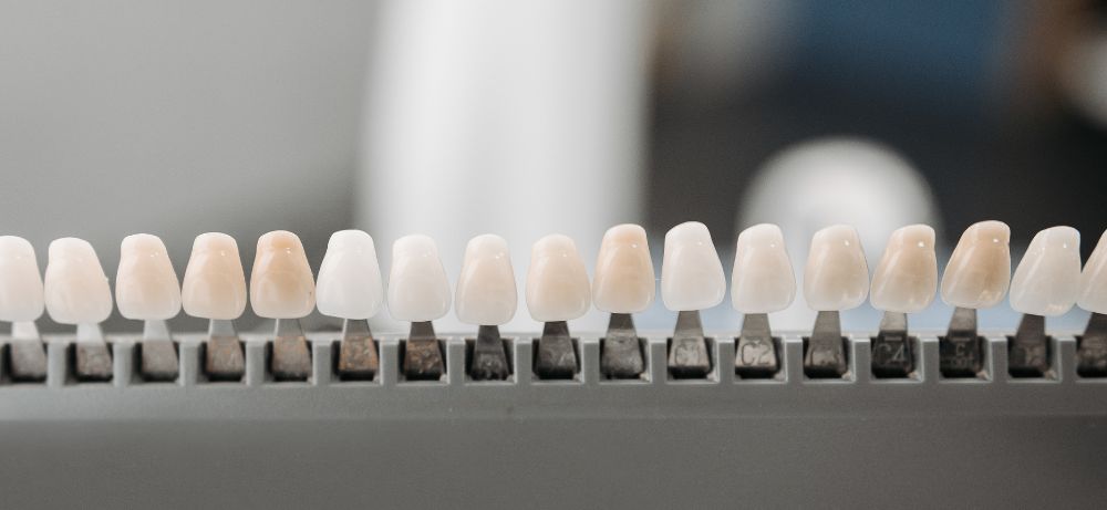 olika nyanser av skalfasader olika nyanser av skalfasader