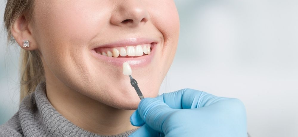 porslinsfasader Tandläkare går igenom processen för estetisk tandvård för patient